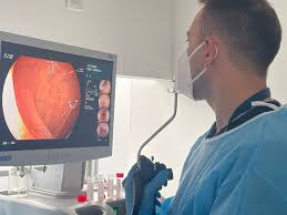 Endoscopias